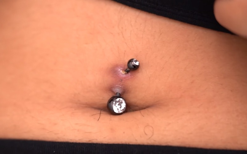 How To Get Rid Of Hyperpigmentation Around Belly Button Piercing