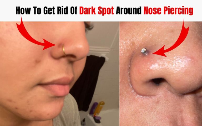 how-to-get-rid-of-dark-spot-around-nose-piercing-4-methods