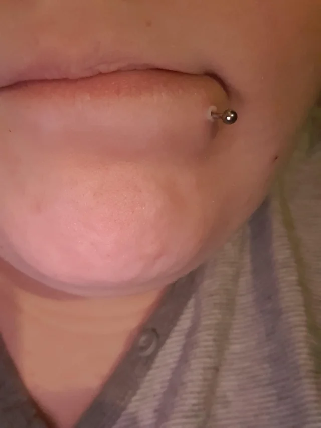 White Ring Around Lip Piercing